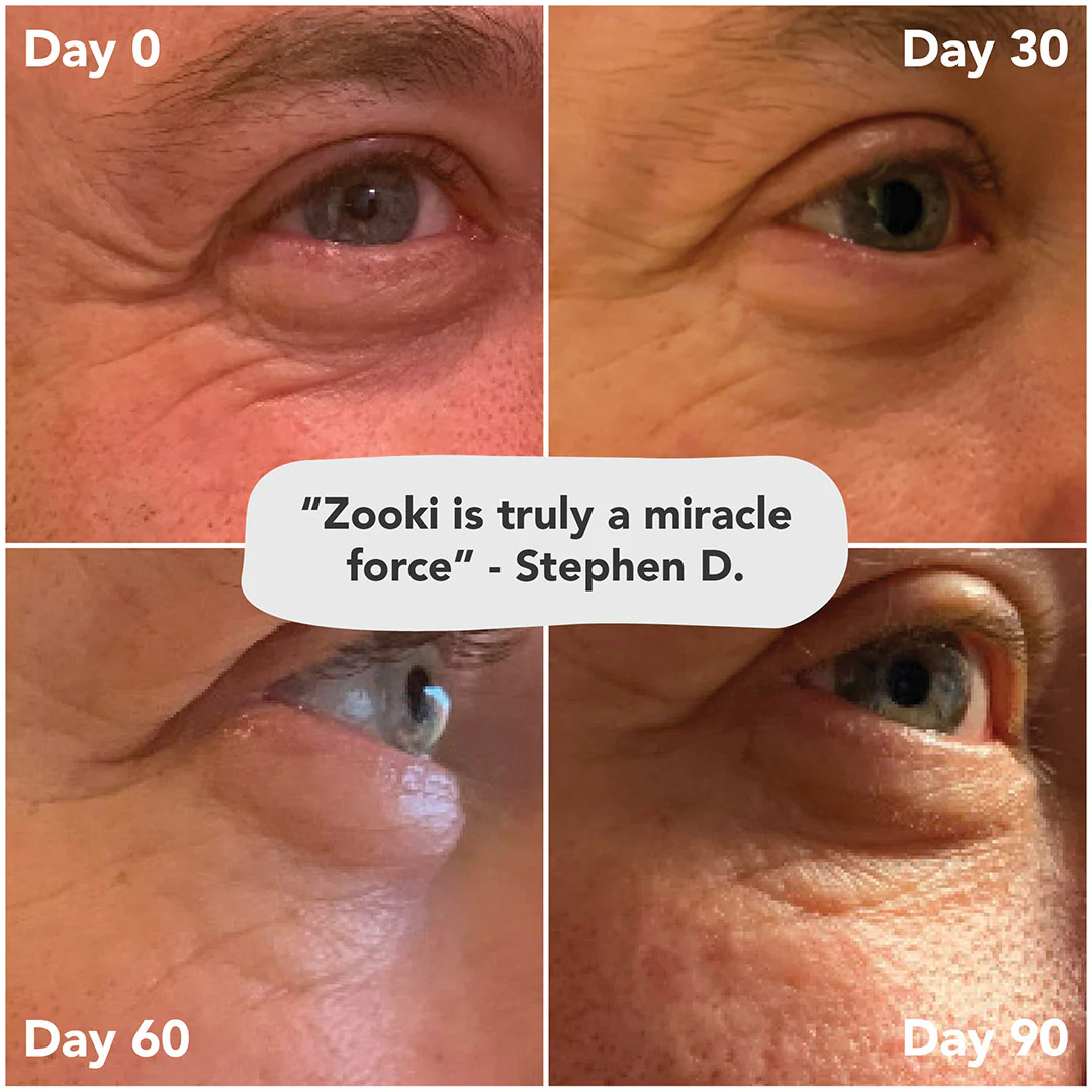 Collagen, 5,000mg - Image 21